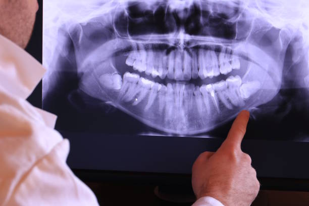 Best Emergency Treatment for Jaw Pain or Injury in El Verano, CA